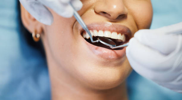 Best After-Hours Dental Trauma Care in Stevensville, MT