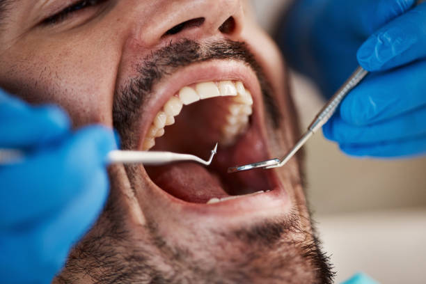 Best Emergency Denture Repair in Stevensville, MT