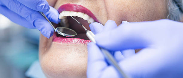 Best Emergency Tooth Extraction in Stevensville, MT